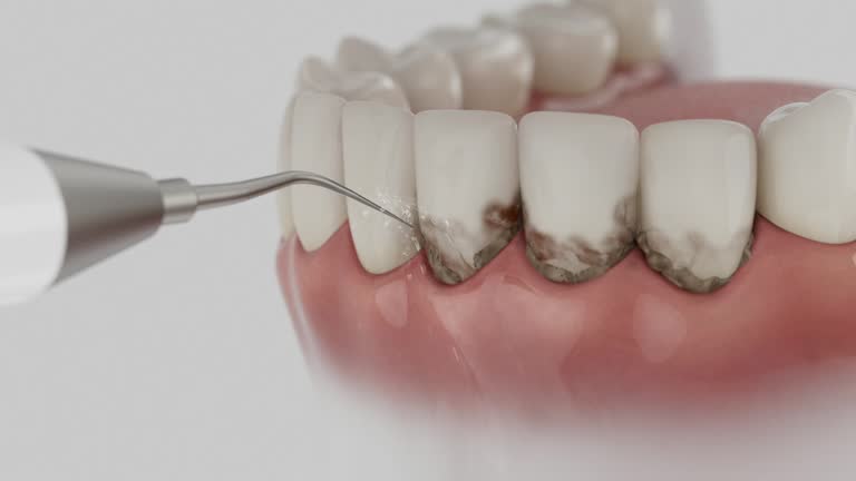 Reliable Emergency Dentist contractor in Dinuba, CA by Smile Center Dentistry